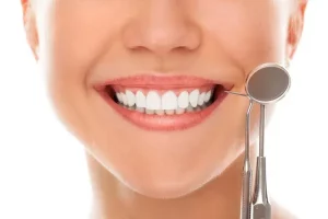 bọc răng sứ bao lâu thì xong
