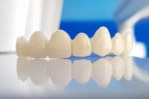 bọc răng sứ giá bao nhiêu