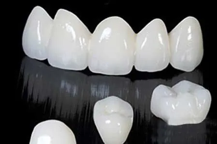 Yếu tố ảnh hưởng đến giá bọc răng sứ