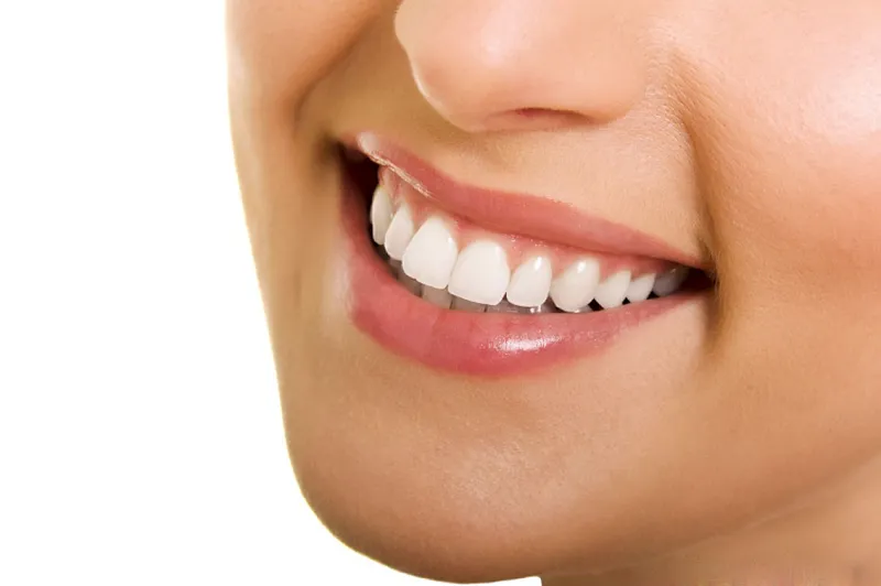 Cải thiện thẩm mỹ nụ cười