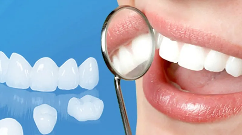 Răng bị sứt mẻ, vỡ lớn