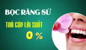 bọc răng sứ trả góp