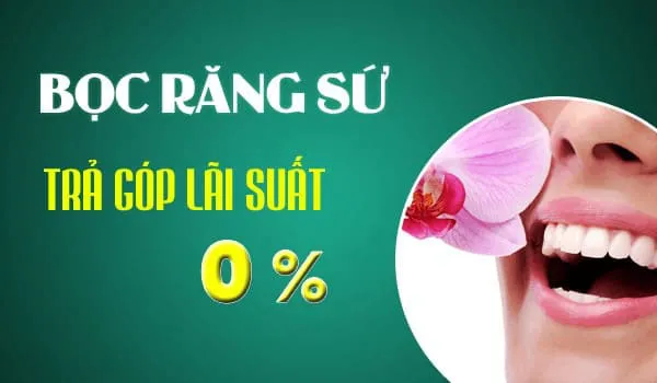 bọc răng sứ trả góp