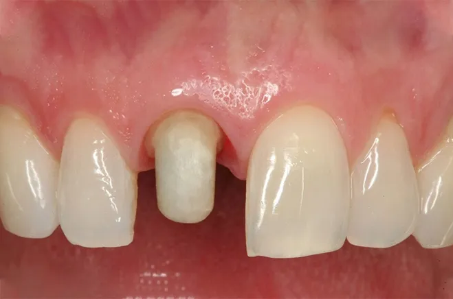 Cải thiện thẩm mỹ tối đa