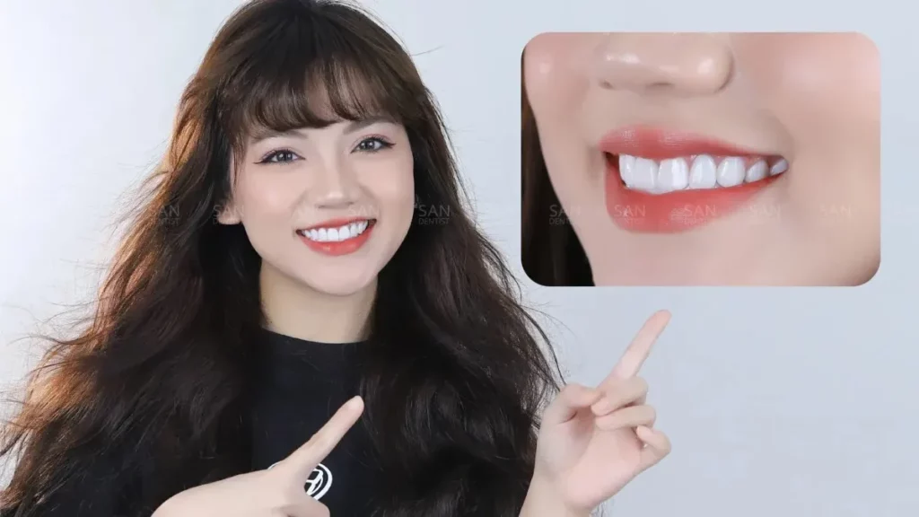 Các tiêu chí đánh giá một nha khoa bọc răng sứ uy tín