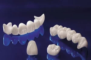 nên chọn loại răng sứ nào