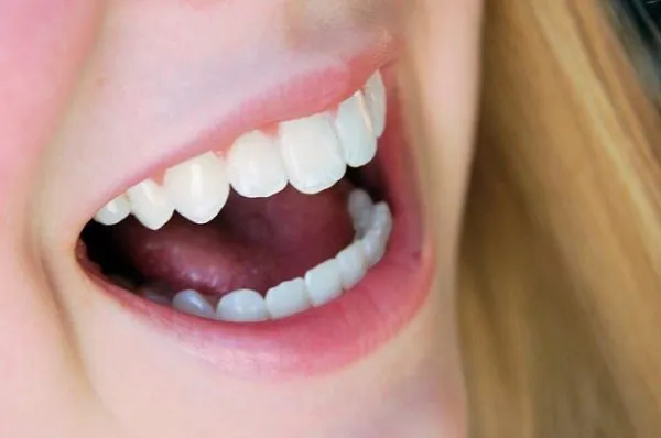 Cấu tạo và đặc điểm của răng sứ Cercon