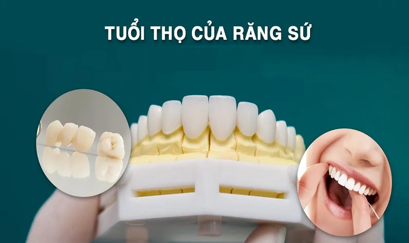 răng sứ có bền không