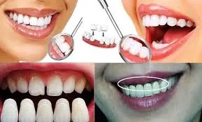 răng sứ có bị hôi miệng không