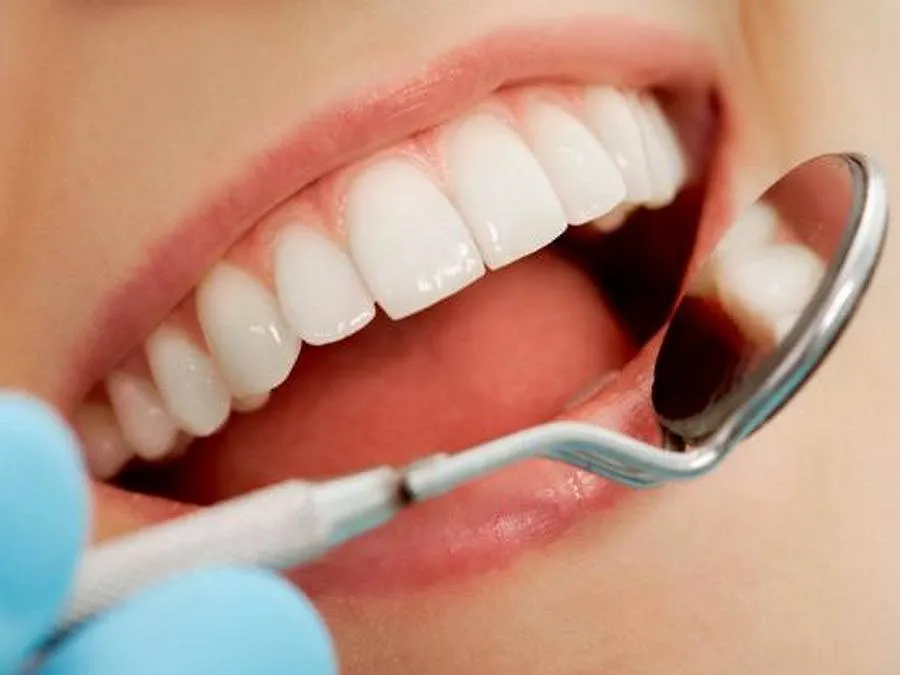 Nguyên nhân gây hôi miệng sau khi bọc răng sứ