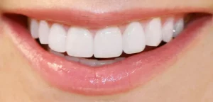 răng sứ có cắn được đồ cứng không