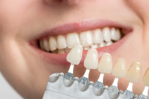 Răng sứ có trắng tự nhiên không?