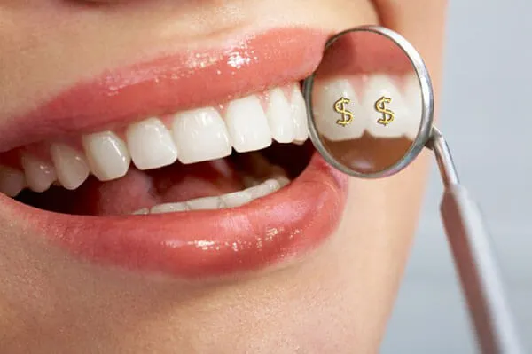 Răng sứ dùng được bao lâu?