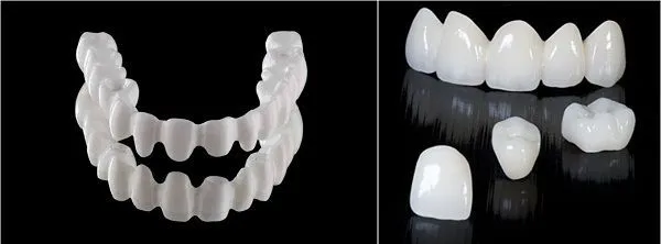 Hiểu đúng về chi phí bọc răng sứ thẩm mỹ