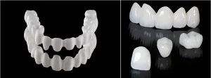răng sứ thẩm mỹ giá rẻ