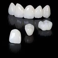 Bí quyết để bọc răng sứ thẩm mỹ với chi phí hợp lý mà vẫn chất lượng