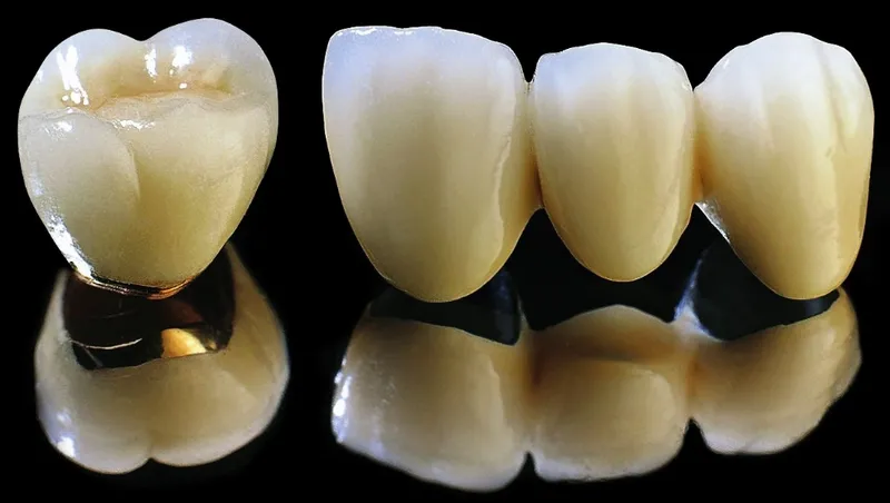 Lớp sườn kim loại bên trong
