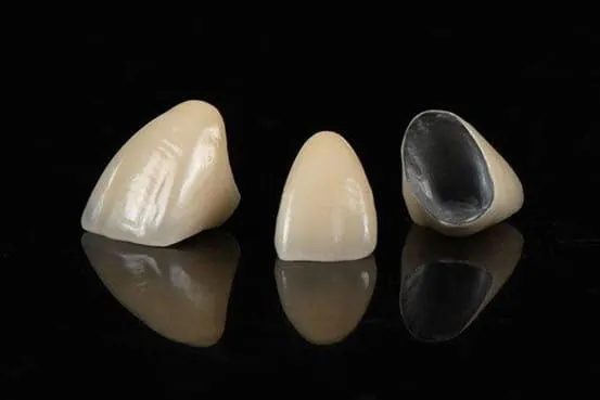 Răng sứ toàn sứ là gì?