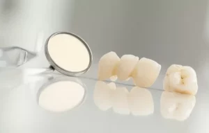 tuổi thọ của răng sứ