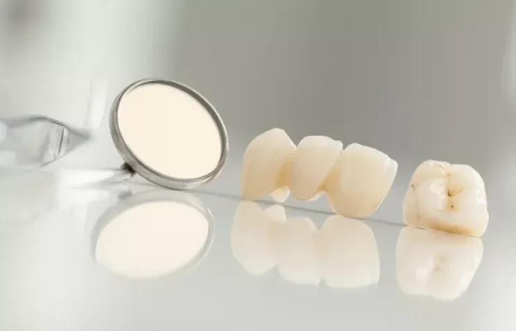 tuổi thọ của răng sứ